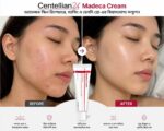 Centellian24 Madeca Cream Time Reverse