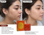 Dr. Alvin Kojic Acid Soap (Professional Skin Care Formula)
