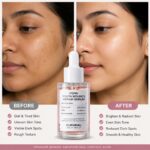 Hueheal PDRN Bounce Repair Serum
