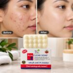 Bio Active Acne Clear Soap (Salicylic Acid 2% Solution)