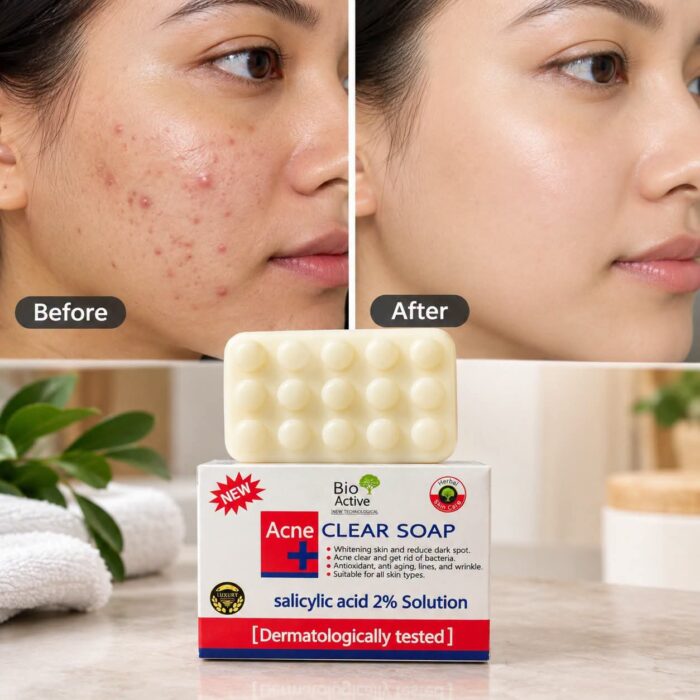 Bio Active Acne Clear Soap (Salicylic Acid 2% Solution)